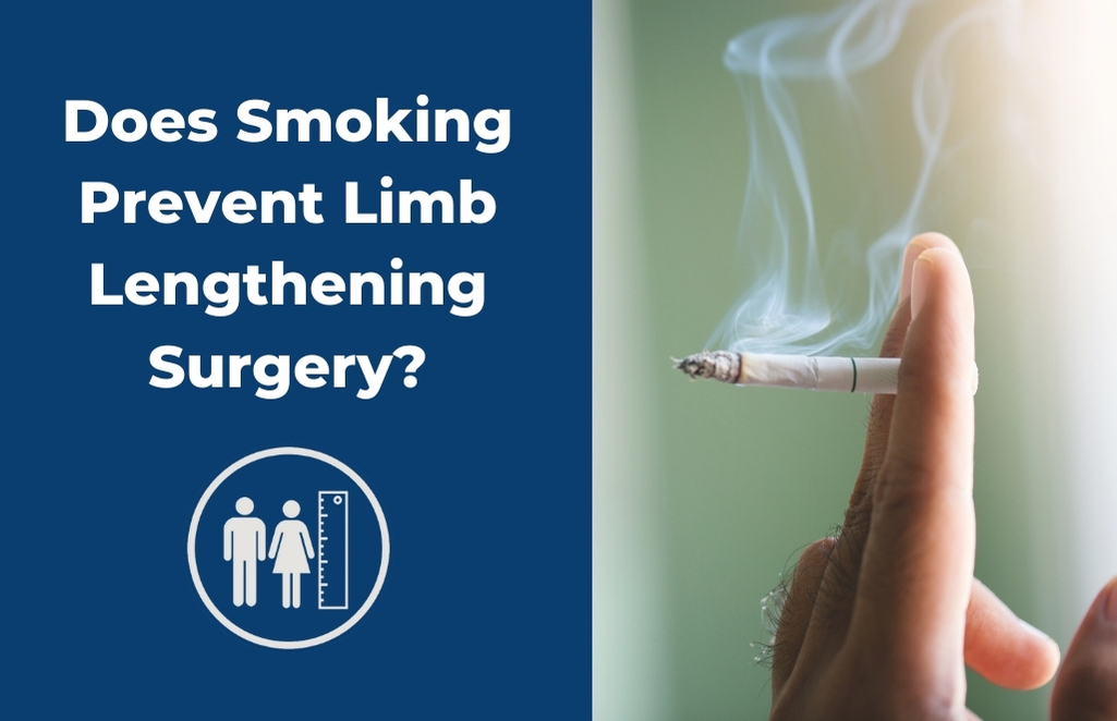 Does Smoking Prevent Limb Lengthening Surgery