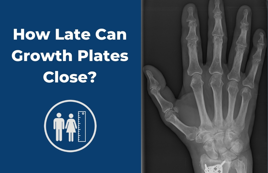 How Late Can Growth Plates Close?
