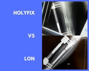 holyfix vs lon method the difficult choice