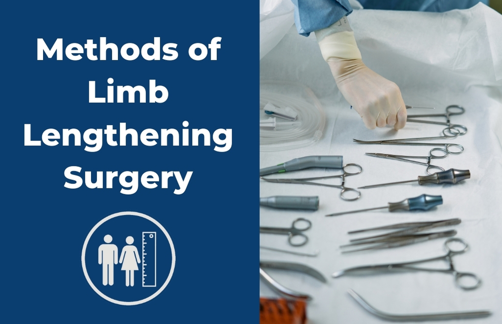 Methods of Limb Lengthening Surgery