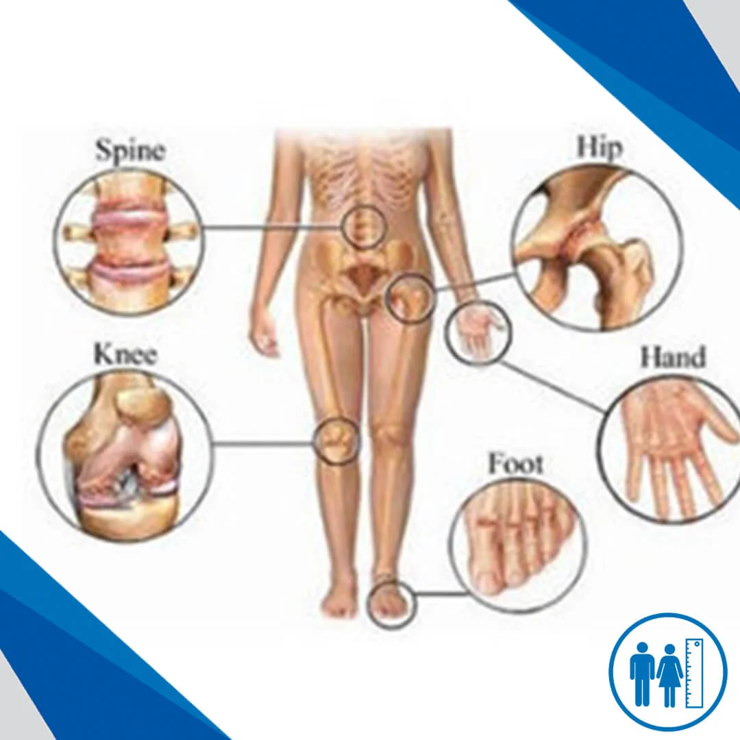 Orthopedic Surgeries And Treatments We Offer