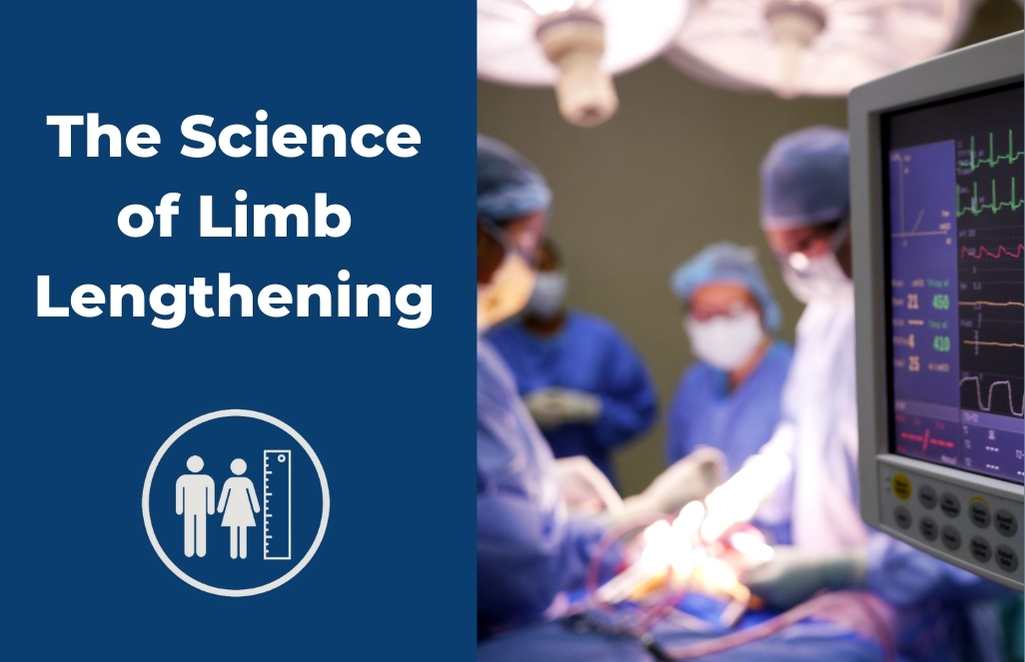 The Science of Limb Lengthening