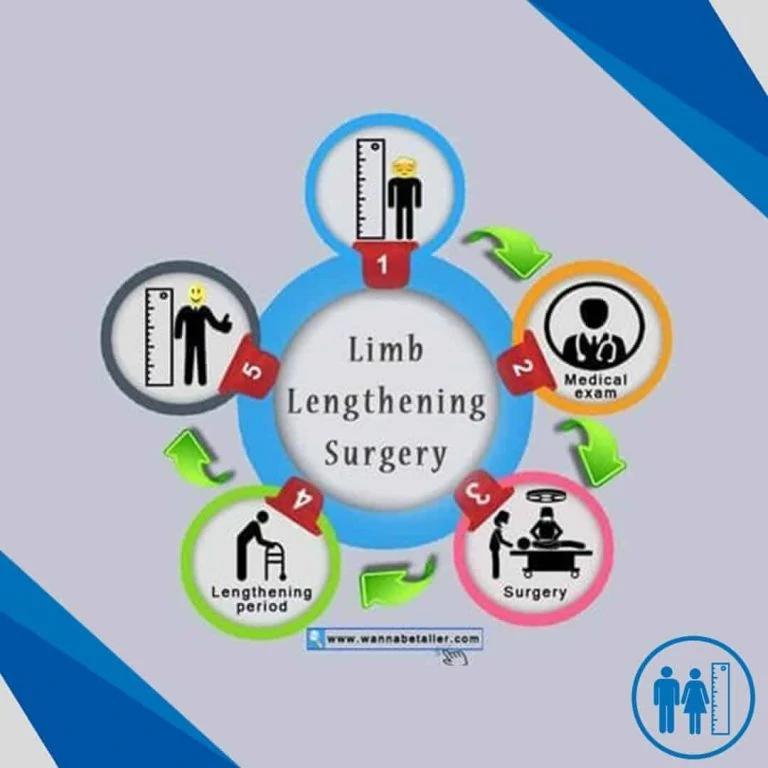 What Is Limb Lengthening Surgery?