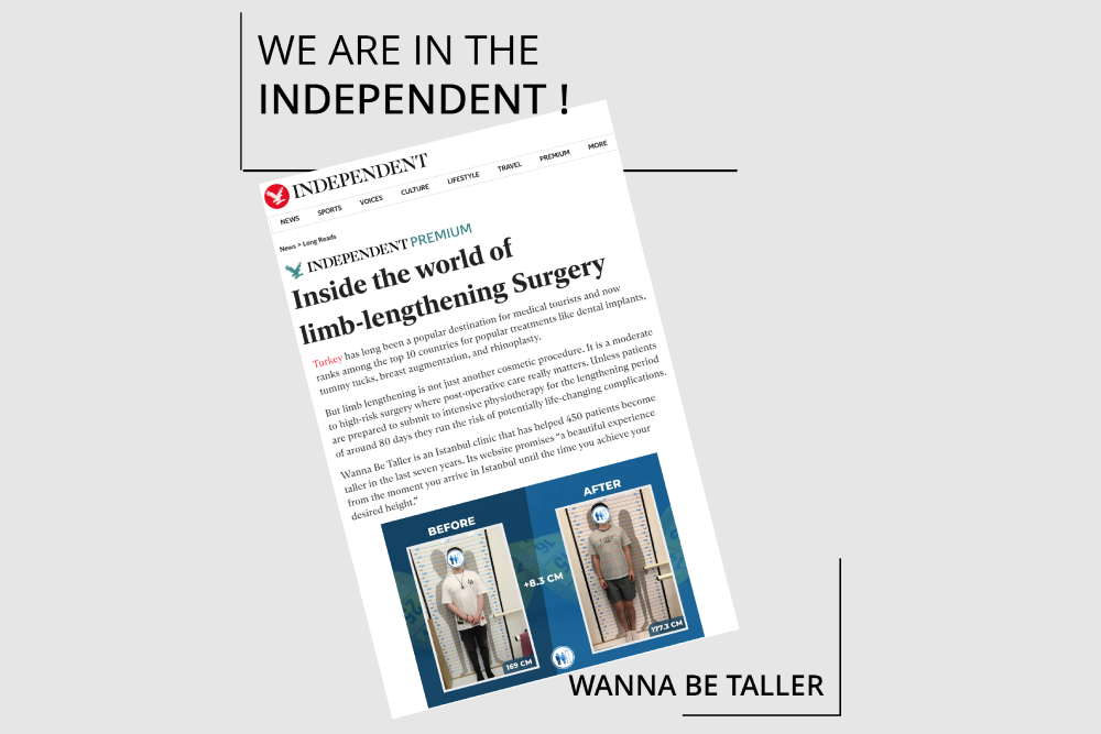 Independent Limb Lengthening Surgery News about Wanna Be Taller