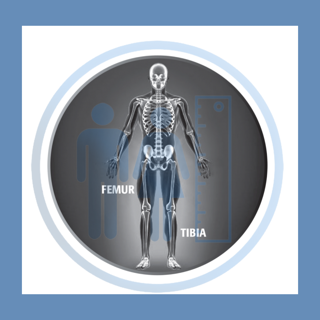 Femur Tibia Limb Lengthening