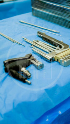 Intramedullary nail and external fixator materials