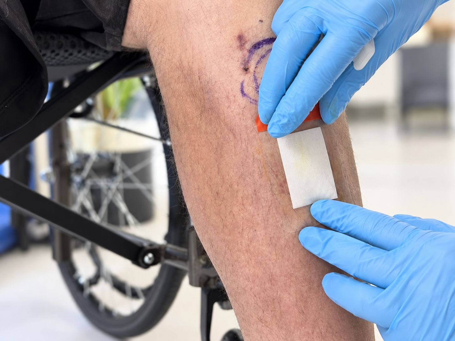 Fitbone incision dressing
