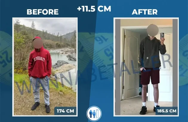 Before After 5