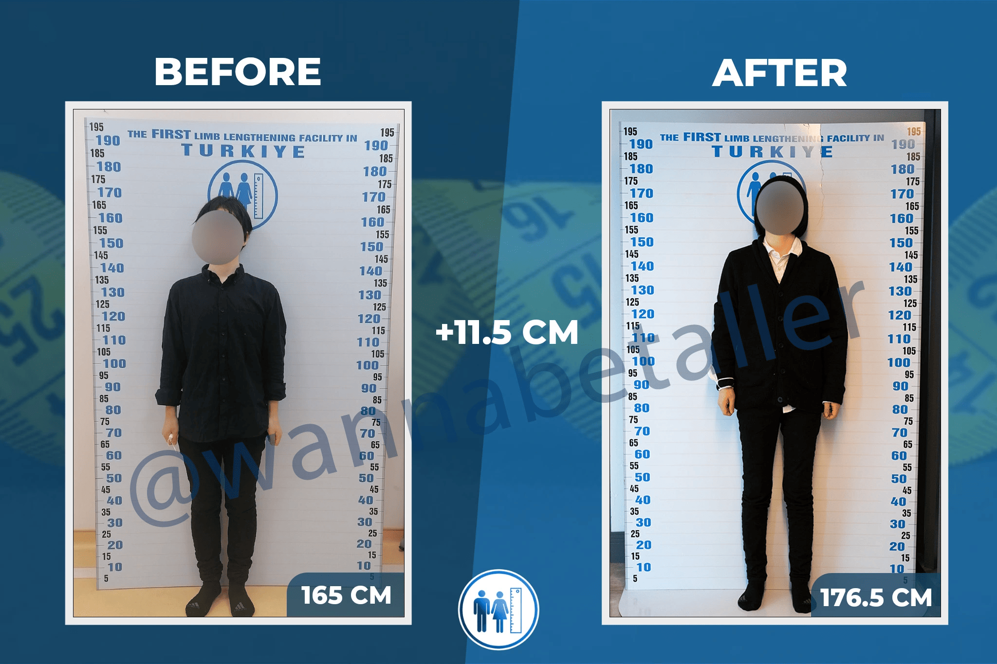 Patient's before-after picture