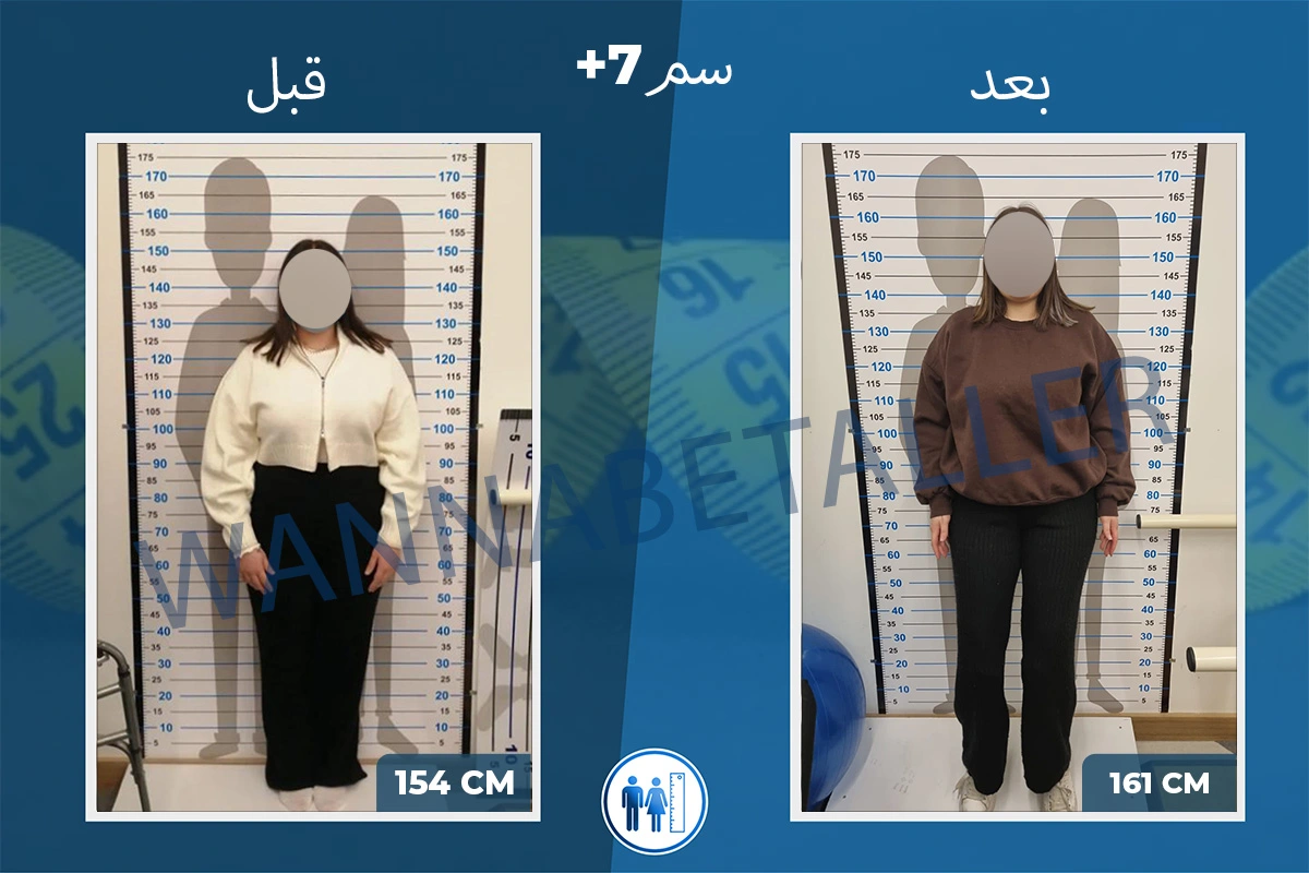 limb-lengthening-surgery-before-after-ar-2