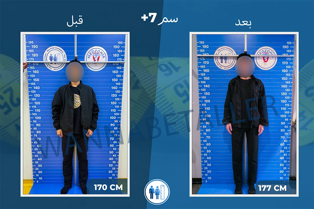 limb-lengthening-surgery-before-after-ar-24