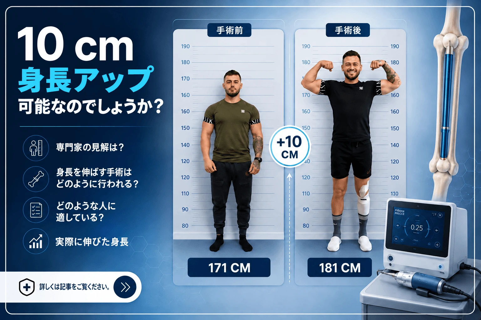 マリウス・グロスの脚延長手術前後:171 cmから181 cmへ