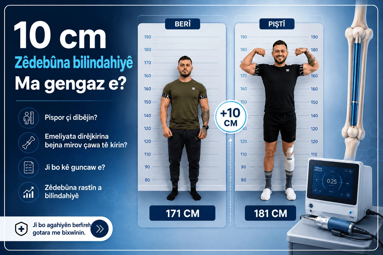 Marius Gros berî û piştî emeliyata dirêjkirina lingan, ji 171 cm heta 181 cm