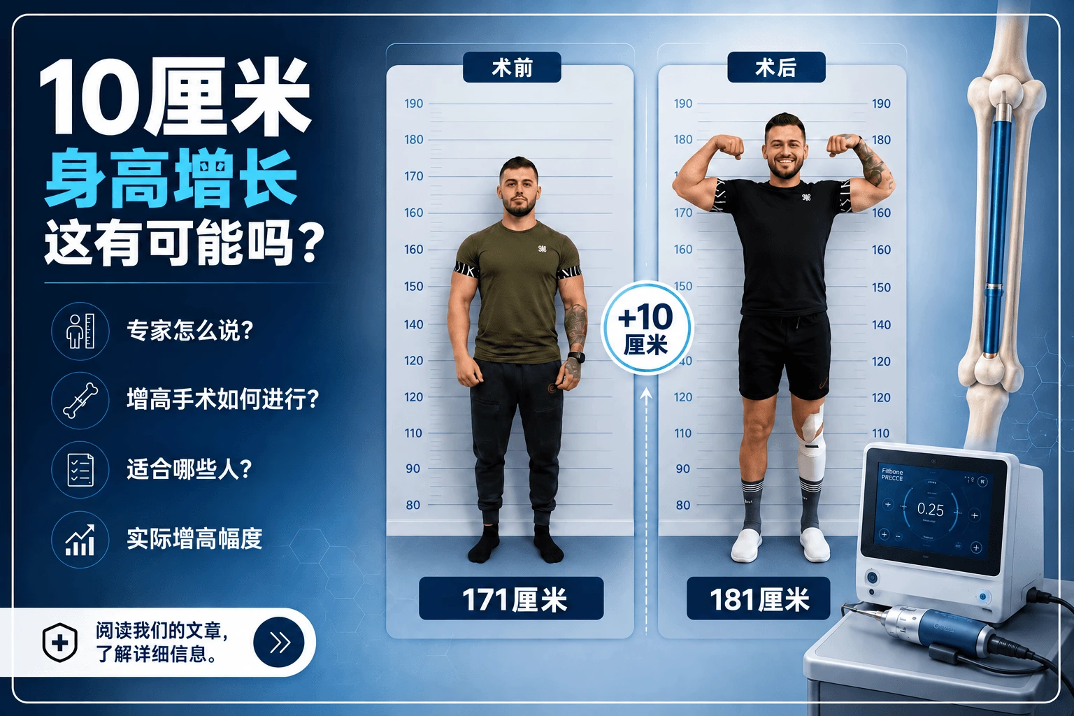 Marius Gros肢体延长手术前后对比，身高从171厘米增至181厘米
