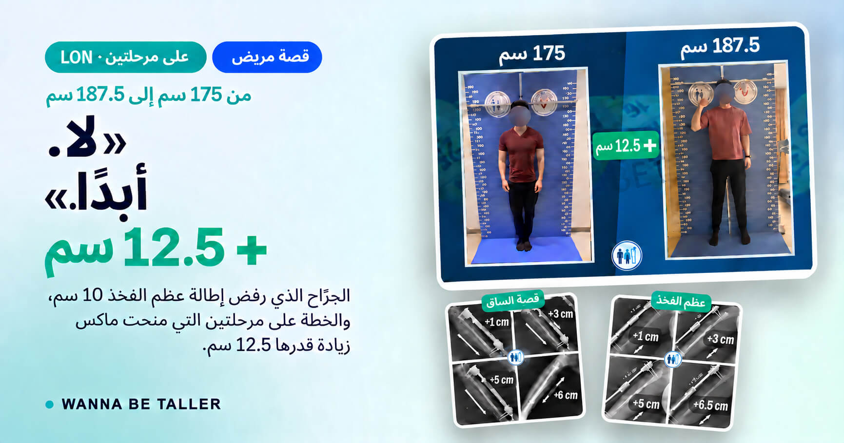 من 175 سم إلى 187.5 سم: رحلة ماكس الكاملة