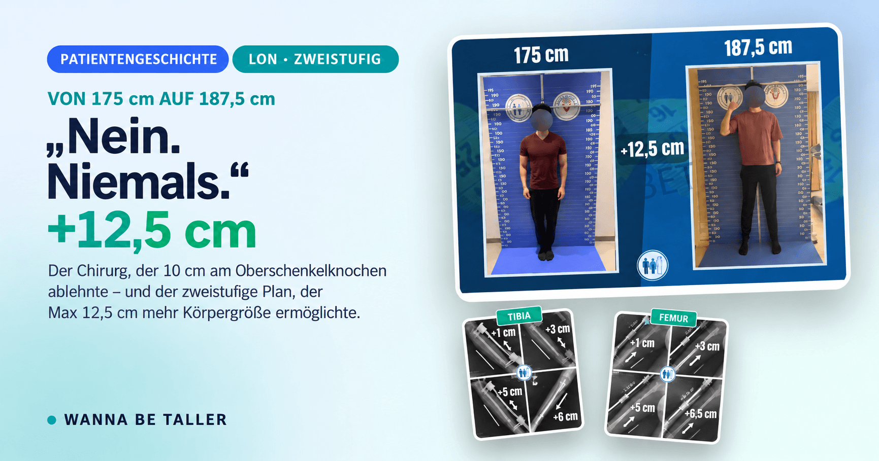 Von 175 cm auf 187,5 cm: Max’ gesamter Weg