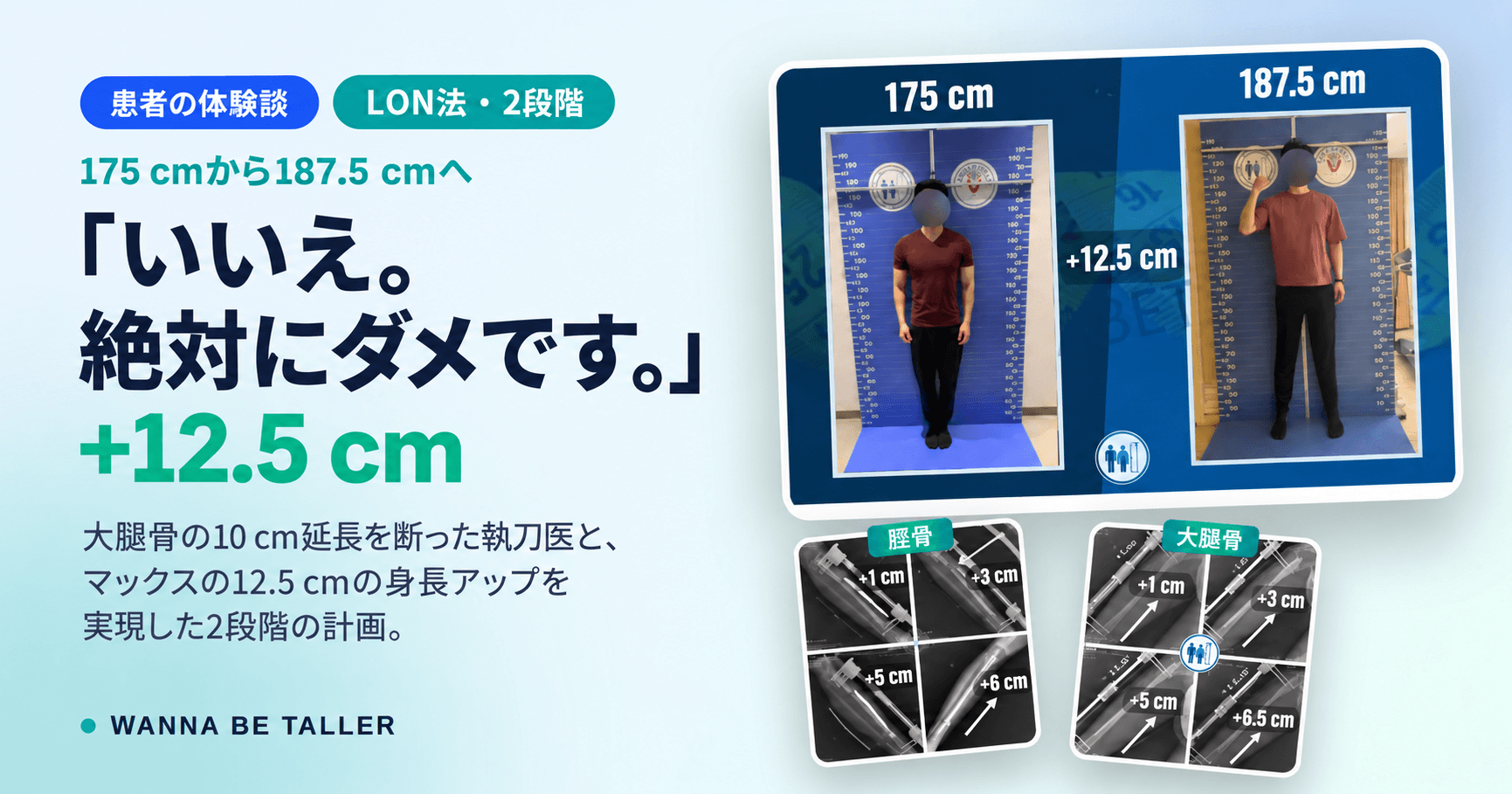 175 cmから187.5 cmへ：Maxさんの治療の全記録