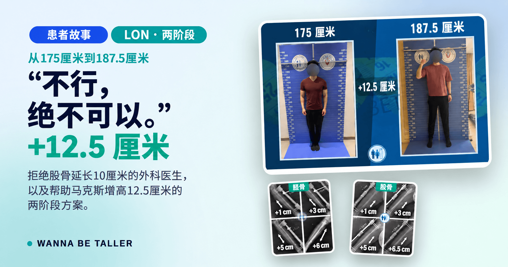 从175厘米到187.5厘米：Max的完整历程
