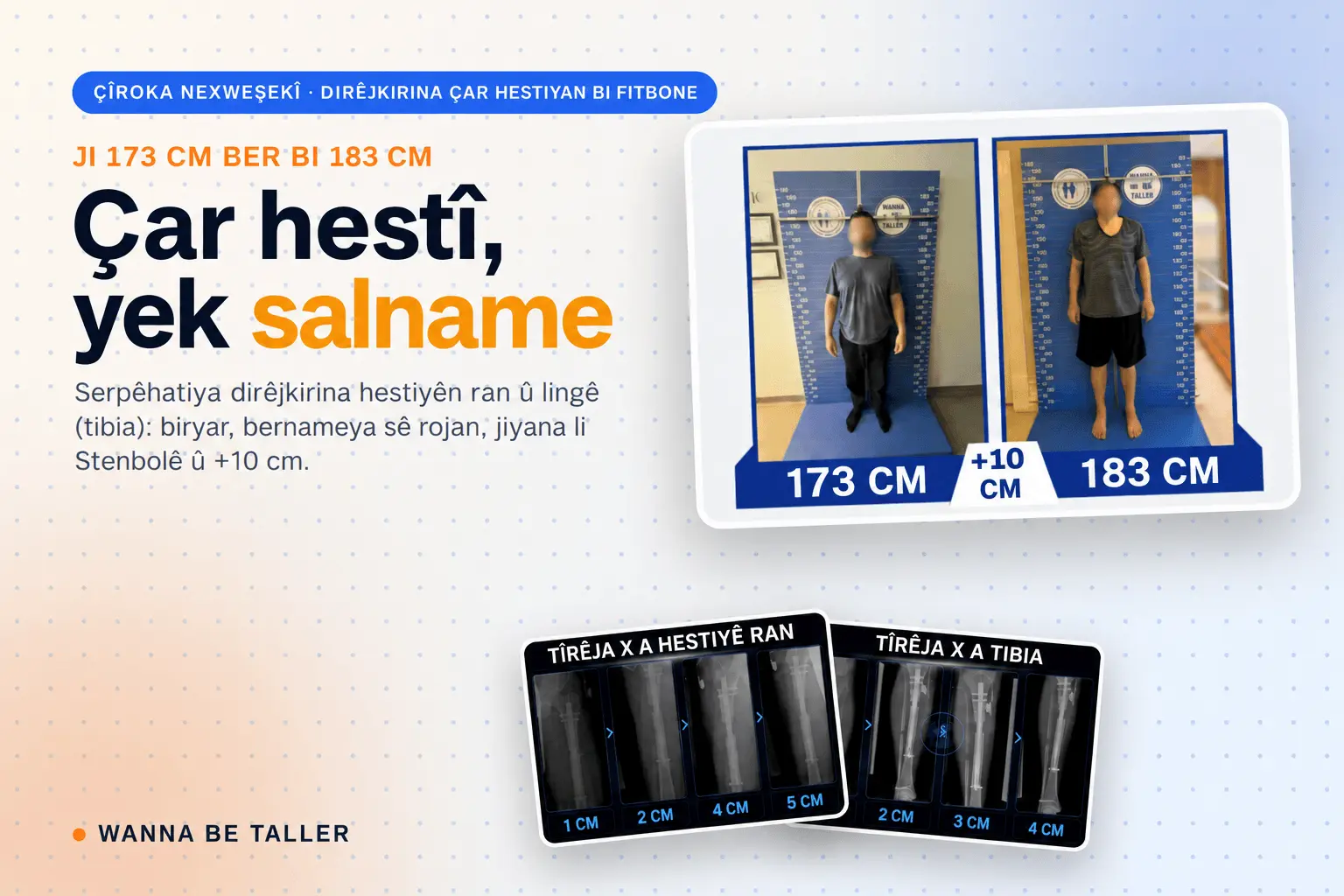 Dirêjkirina ran û lingê jêrîn di her du lingan de bi Fitbone: rêwîtiyeke +10 cm