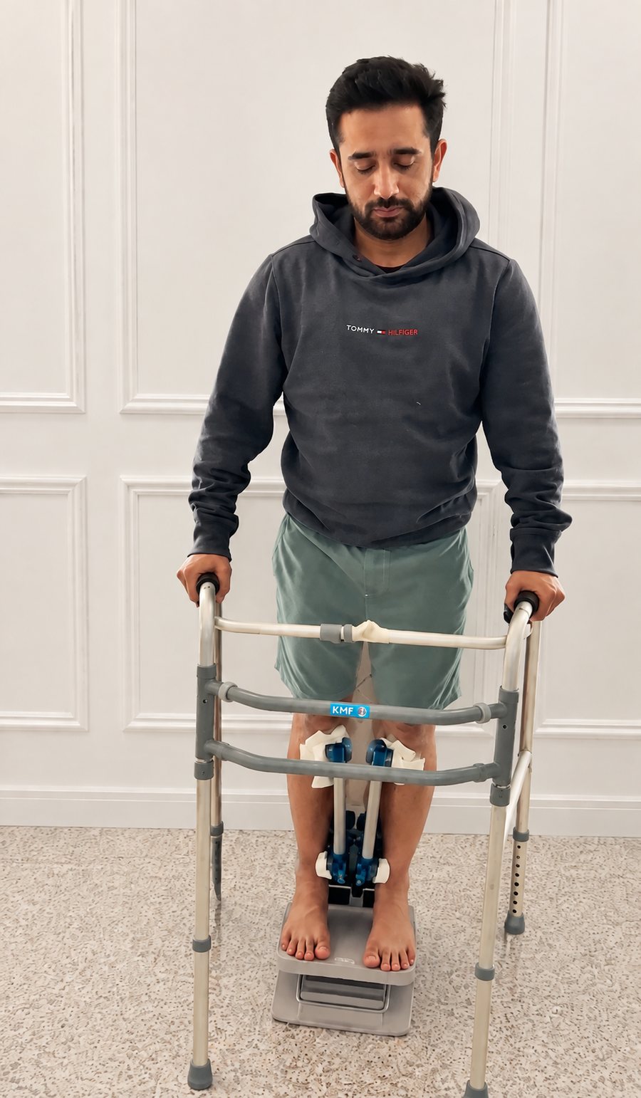 Patient standing with a walker during tibia lengthening